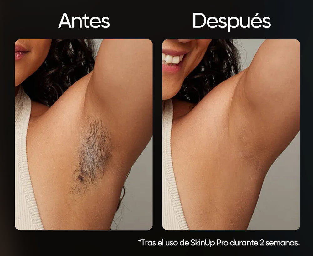 SkinUp Pro