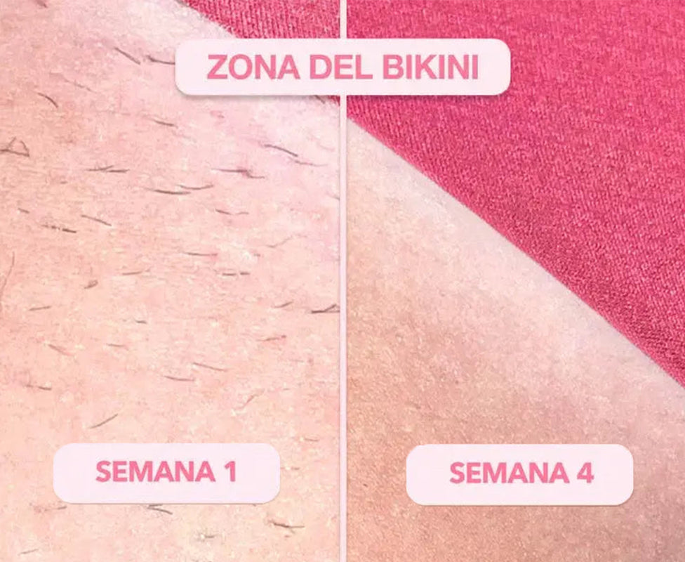 SkinUp Clásica