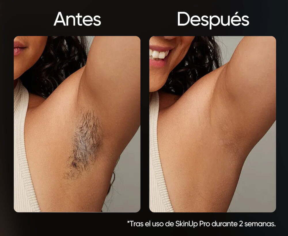 SkinUp Pro