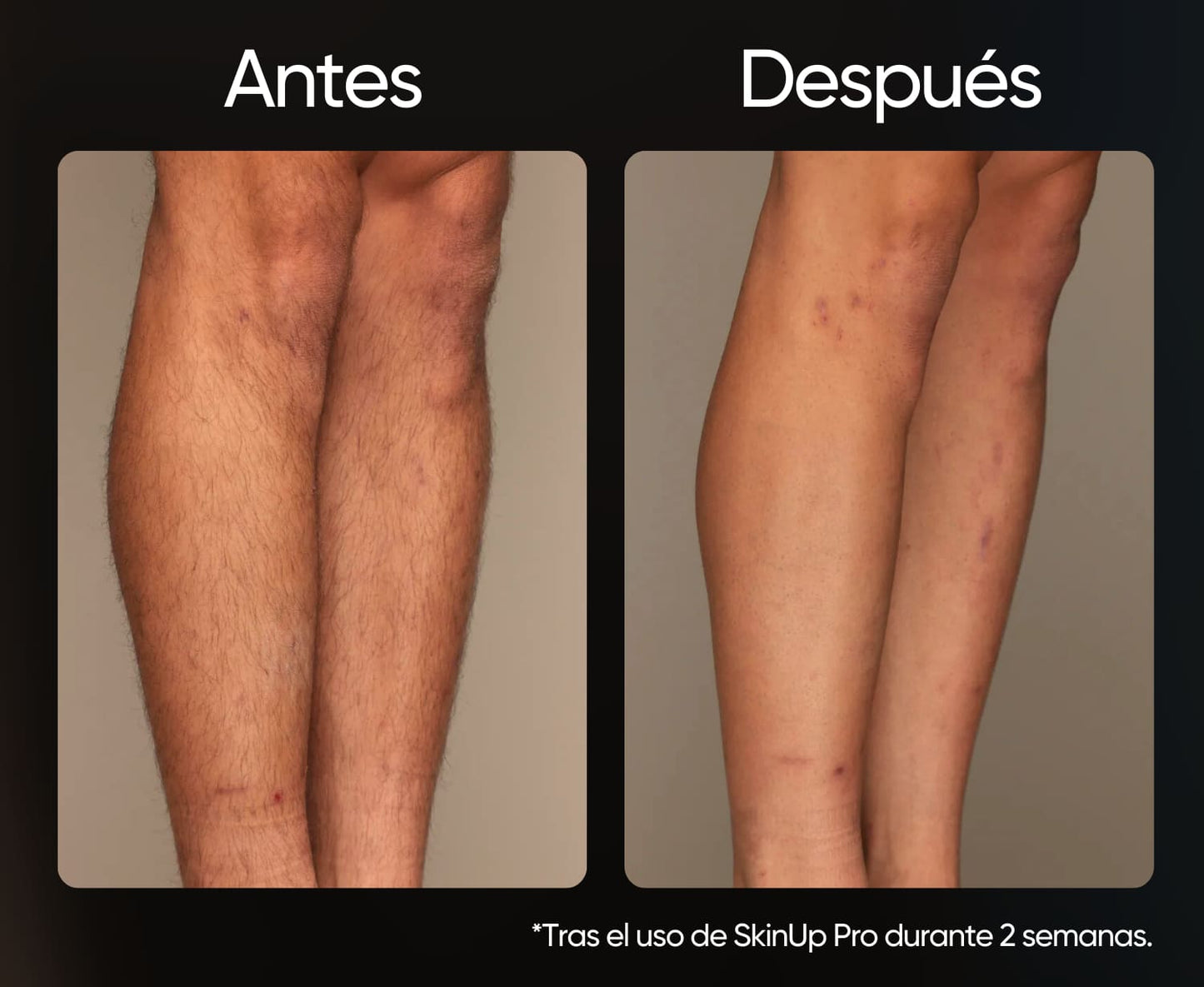 SkinUp Pro