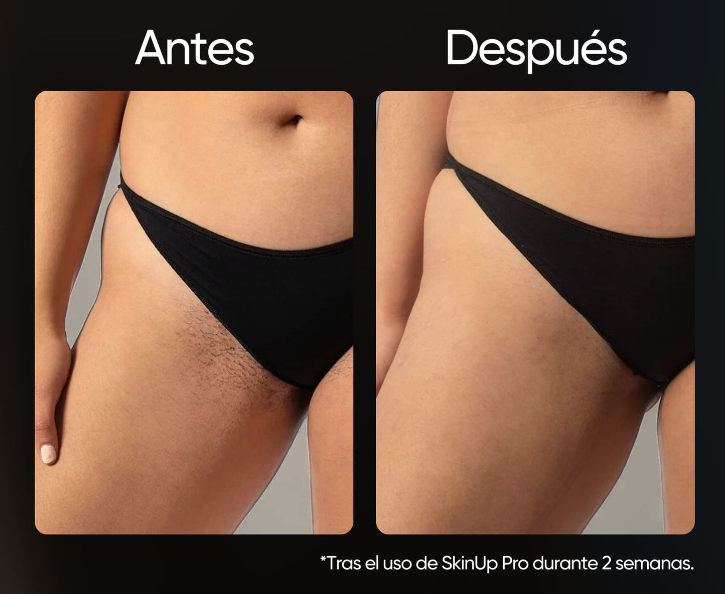 SkinUp Pro