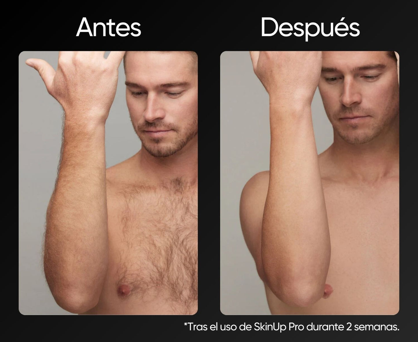 SkinUp Pro - Black Edition