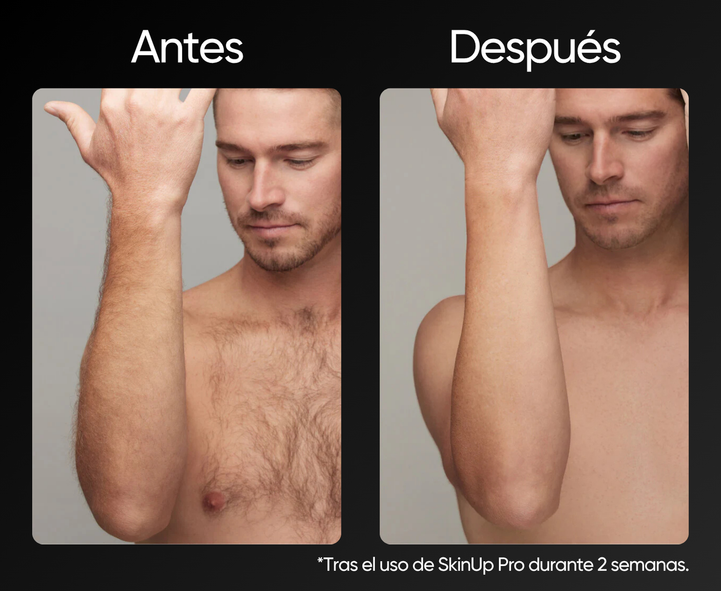 SkinUp Pro - Black Edition