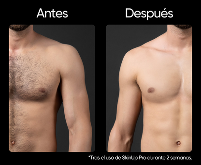 SkinUp Pro - Black Edition