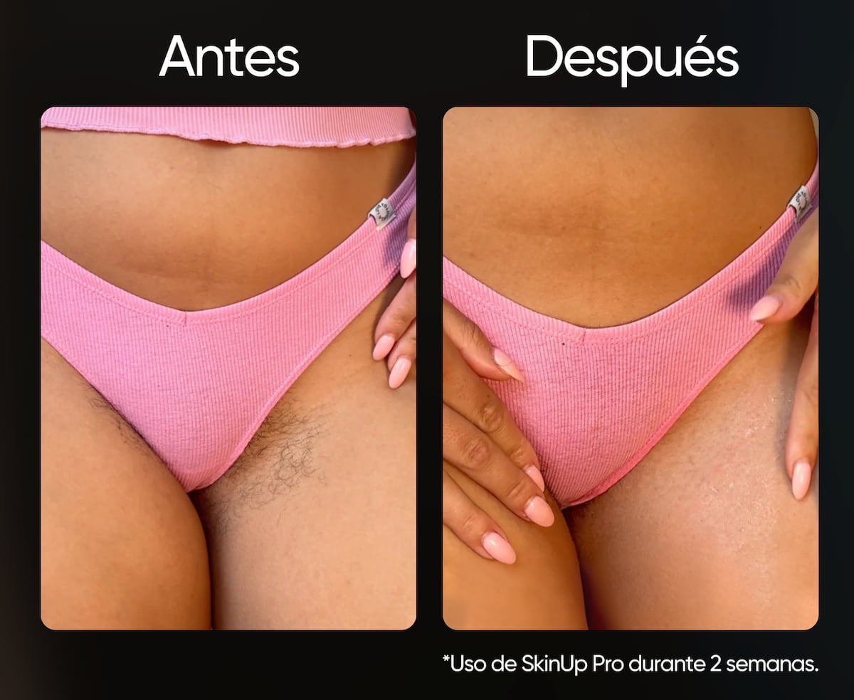 SkinUp Pro