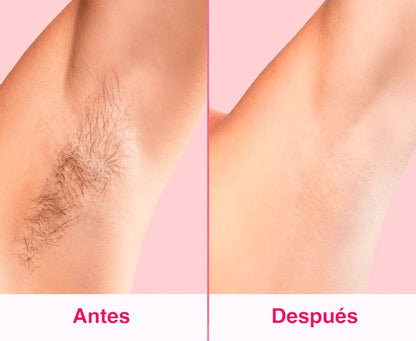 Depiladora IPL Permanente