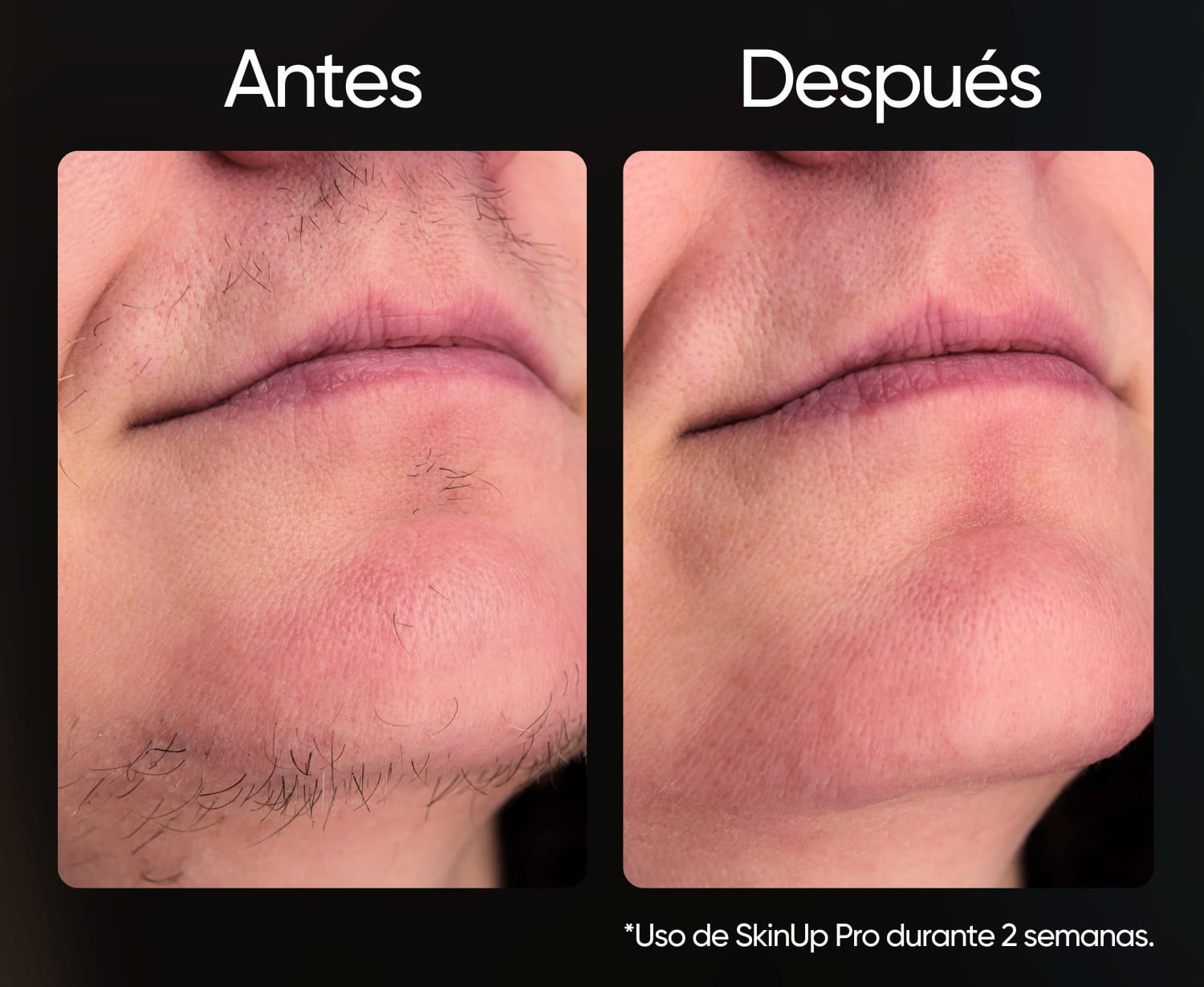 SkinUp Pro